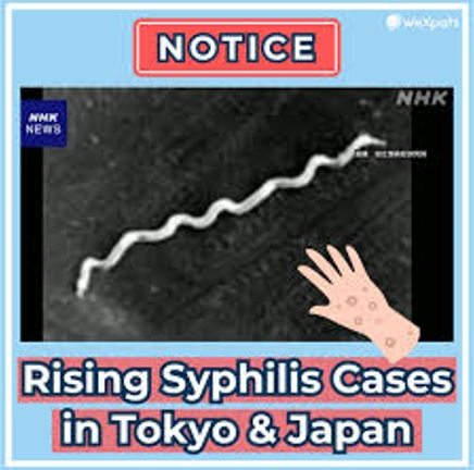 rising-syphilis-cases-in-tokyo rising syphilis cases in tokyo Japan